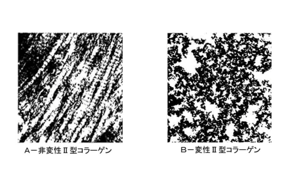 非変性Ⅱ型コラーゲンの比較画像